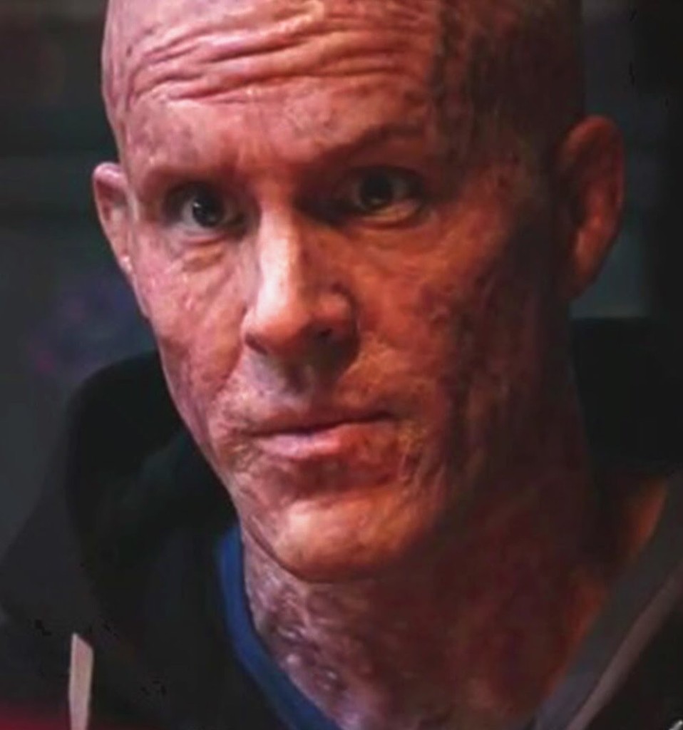 Wade Wilson (Ryan Reynolds) no longer looks like himself as he transforms into the unwilling hero Deadpool.