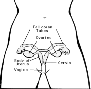 Ovarian Cancer starts in the ovaries and is very difficult to detect. (Image Americancancersociety.org)