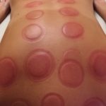 Cupping Result