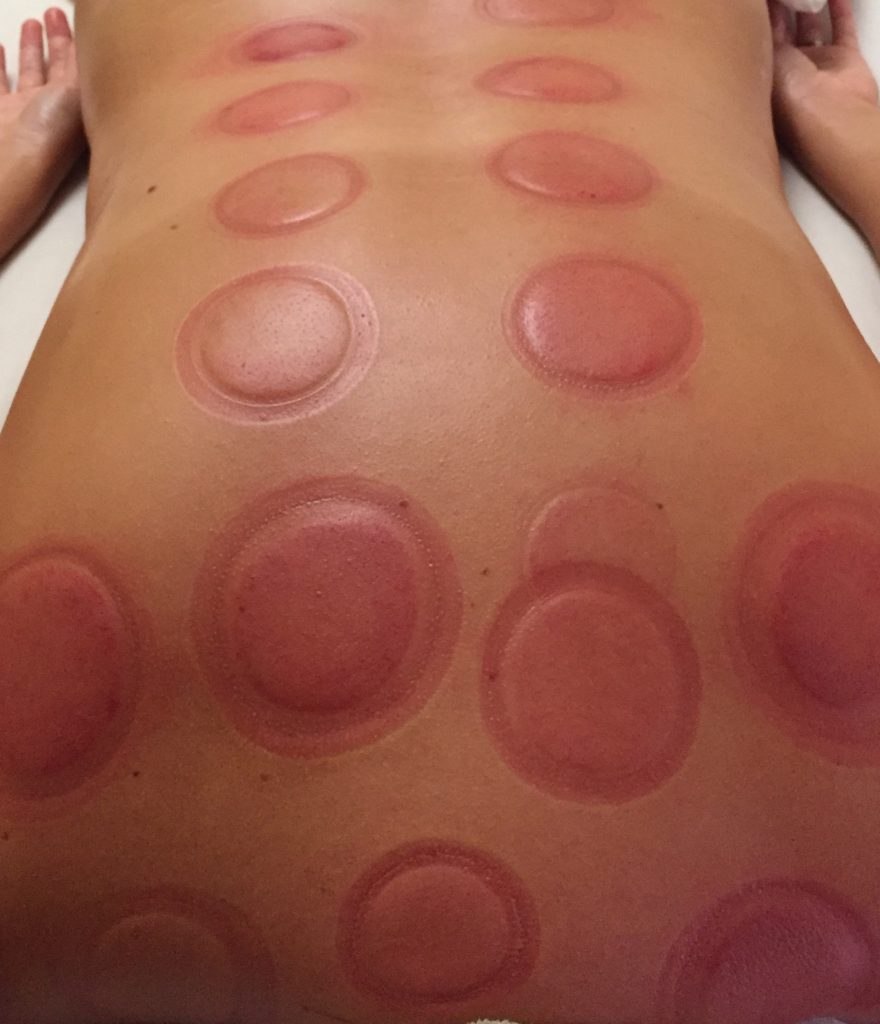 Cupping Result