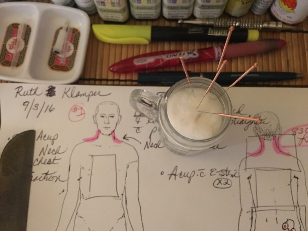 Medical form and acupuncture needles