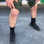 Border Agent Injury1